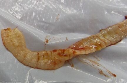 Parasiten im Körper